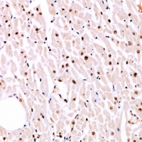 19 - Anti-MITF (Phospho-S180) Antibody AP61064