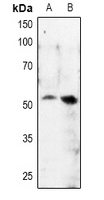 1 - Anti-MITF (Phospho-S180) Antibody AP61064