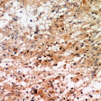 19 - Anti-RSK1 (Phospho-T359/S363) Antibody AP61065