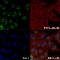 3 - Anti-PTEN (Phospho-S385) Antibody AP61066
