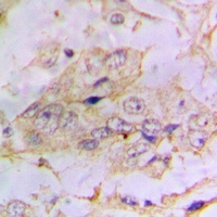 19 - Anti-PTEN (Phospho-S385) Antibody AP61066