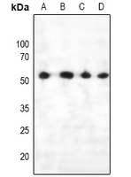 1 - Anti-PTEN (Phospho-S385) Antibody AP61066