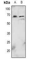 1 - Anti-AKT (Phospho-T72) Antibody AP61067