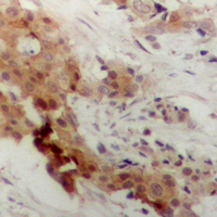 19 - Anti-MK2 (Phospho-T222) Antibody AP61068