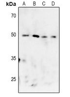 1 - Anti-MK2 (Phospho-T222) Antibody AP61068