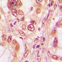 19 - Anti-p53 (Phospho-T81) Antibody AP61069