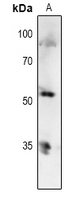 1 - Anti-p53 (Phospho-T81) Antibody AP61069