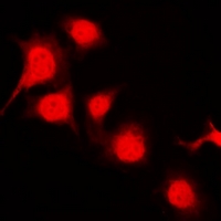 3 - Anti-BRK (Phospho-Y447) Antibody AP61070