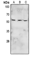 1 - Anti-BRK (Phospho-Y447) Antibody AP61070