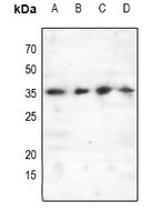 1 - Anti-C/EBP epsilon (Phospho-T74) Antibody AP61071