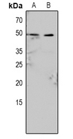 1 - Anti-Caspase 9 (Phospho-Y153) Antibody AP61072