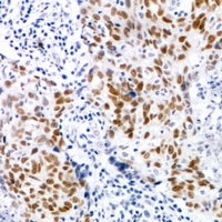 19 - Anti-CDK7 (Phospho-T170) Antibody AP61073