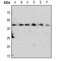 1 - Anti-CDK7 (Phospho-T170) Antibody AP61073