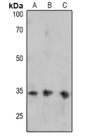 1 - Anti-FOSB (Phospho-S27) Antibody AP61074