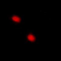 3 - Anti-p57 Kip2 (Phospho-T310) Antibody AP61075