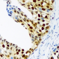 19 - Anti-p57 Kip2 (Phospho-T310) Antibody AP61075