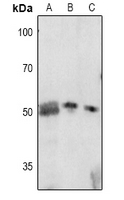 1 - Anti-p57 Kip2 (Phospho-T310) Antibody AP61075