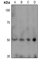 1 - Anti-TPH1 (Phospho-S58) Antibody AP61076