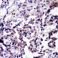19 - Anti-CDK9 (Phospho-T186) Antibody AP61077