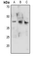 1 - Anti-CDK9 (Phospho-T186) Antibody AP61077
