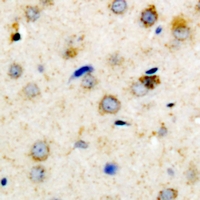 19 - Anti-IGFBP3 (Phospho-S183) Antibody AP61078