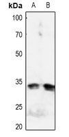 1 - Anti-IGFBP3 (Phospho-S183) Antibody AP61078