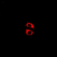 3 - Anti-Kir6.2 (Phospho-T224) Antibody AP61079