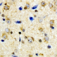 19 - Anti-Kir6.2 (Phospho-T224) Antibody AP61079