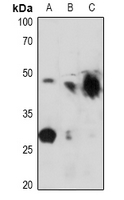 1 - Anti-Kir6.2 (Phospho-T224) Antibody AP61079