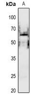 1 - Anti-PAK1 (Phospho-S199) Antibody AP61080