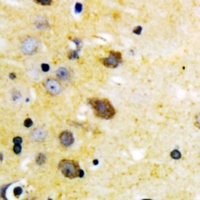 19 - Anti-MKK4 (Phospho-S257) Antibody AP61081