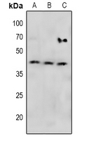 1 - Anti-MKK4 (Phospho-S257) Antibody AP61081