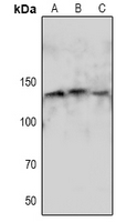 1 - Anti-eNOS (Phospho-S1179) Antibody AP61083