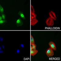3 - Anti-WEE1 (Phospho-S642) Antibody AP61084