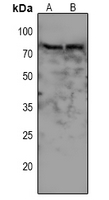 1 - Anti-WEE1 (Phospho-S642) Antibody AP61084