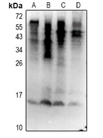 1 - Anti-Ubiquitin (Phospho-S65) Antibody AP61085