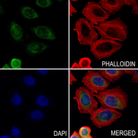 3 - Anti-PINK1 (Phospho-S228) Antibody AP61086