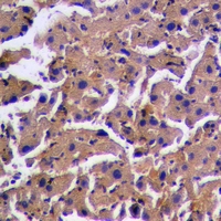 19 - Anti-PINK1 (Phospho-S228) Antibody AP61086