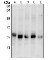 1 - Anti-PINK1 (Phospho-S228) Antibody AP61086
