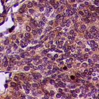 19 - Anti-PINK1 (Phospho-S402) Antibody AP61087