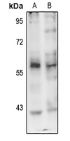1 - Anti-PINK1 (Phospho-S402) Antibody AP61087