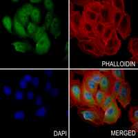 3 - Anti-Histone Deacetylase 2 (Phospho-S394) Antibody AP61088