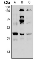 1 - Anti-Histone Deacetylase 2 (Phospho-S394) Antibody AP61088