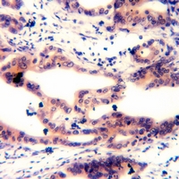 19 - Anti-MARCKS (Phospho-S158) Antibody AP61089