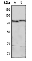 1 - Anti-MARCKS (Phospho-S158) Antibody AP61089