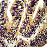 19 - Anti-c-Met (Phospho-S985) Antibody AP61090