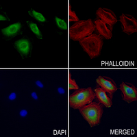 3 - Anti-EPHA8 (Phospho-Y615) Antibody AP61091