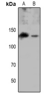 1 - Anti-EPHA8 (Phospho-Y615) Antibody AP61091