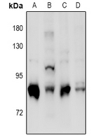 1 - Anti-PKC delta (Phospho-S664) Antibody AP61092
