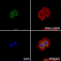 3 - Anti-Vimentin (Phospho-S39) Antibody AP61096